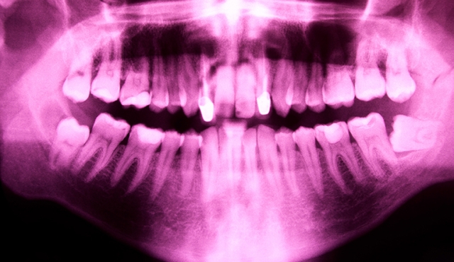 Basic therapy associated with periodontal treatment