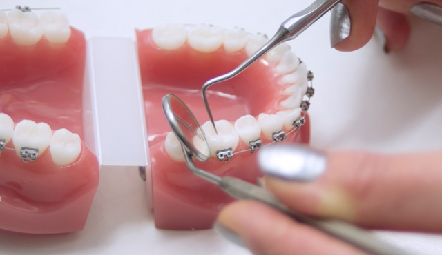 Denture retention means