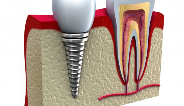 Core: indications, techniques and clinical steps