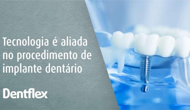 Technology is allied in the dental implant procedure