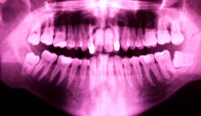 Terapia básica asociada al tratamiento periodontal.