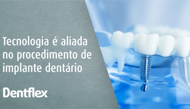 Tecnologia é aliada no procedimento de implante dentário