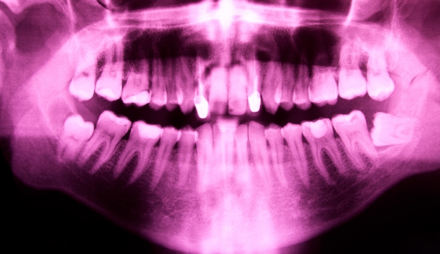 Terapia básica associada ao tratamento periodontal